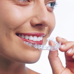 invisalign aligners grand traverse mi