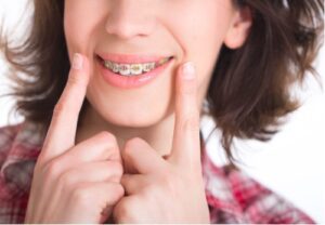 Braces Near Me in Suttons Bay