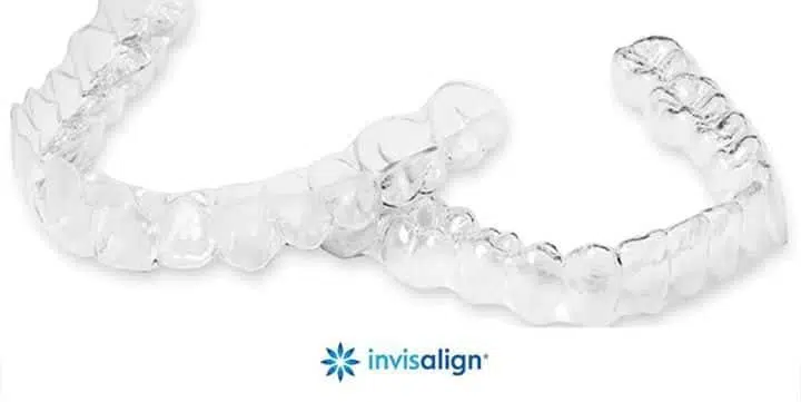 Photo of two Invisalign clear aligners