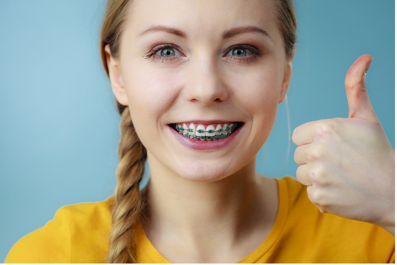 How Old Do You Have to Be to Get Braces? Crucial Signs to Watch For