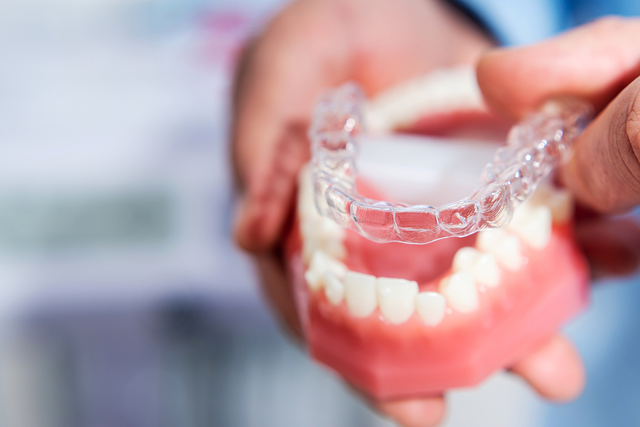 Invisalign 2025 Update: Why It’s a Game-Changer for Your Smile