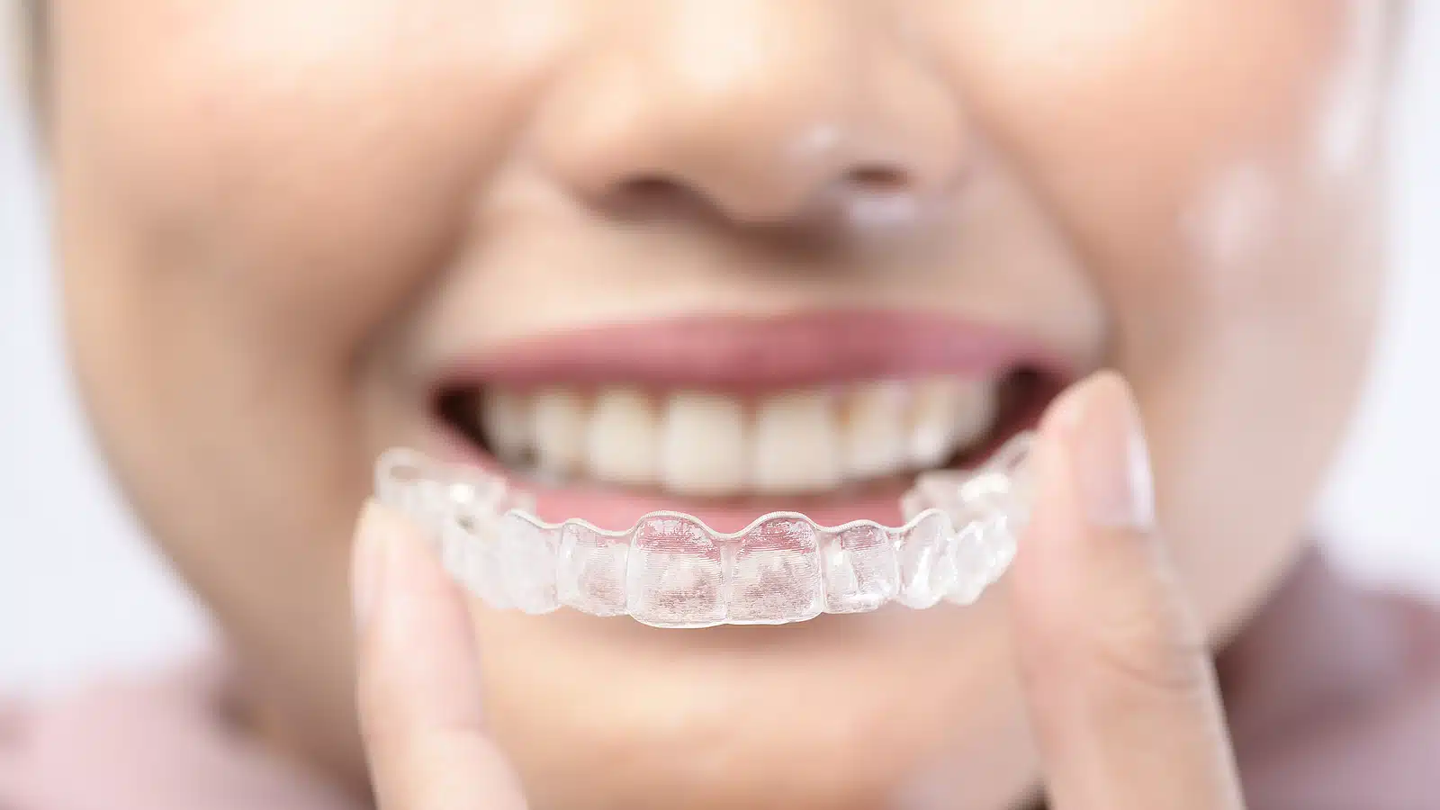 Young female patient holding her Invisalign aligners